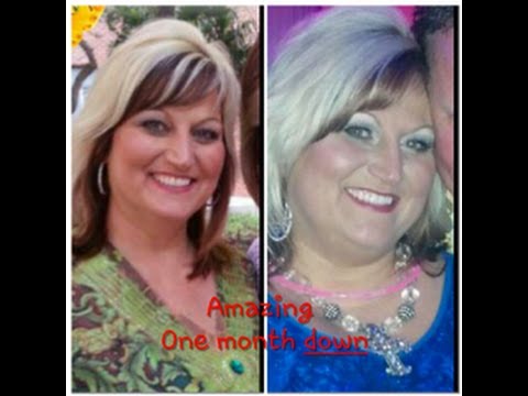 Medical Tourism Mexico, Weight Loss Surgeries By Sheri Burke