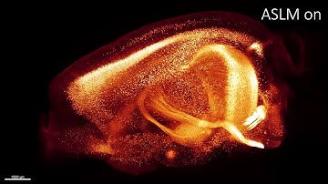 mesoSPIM imaging with and without axially scanned light-sheet microscopy in a Thy1-YFP mouse brain