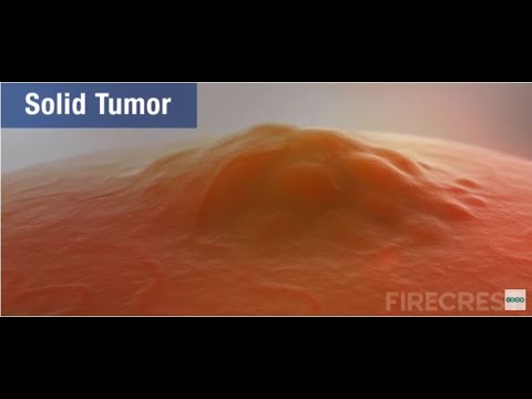 FIRECREST Medical Animations: Solid Tumors