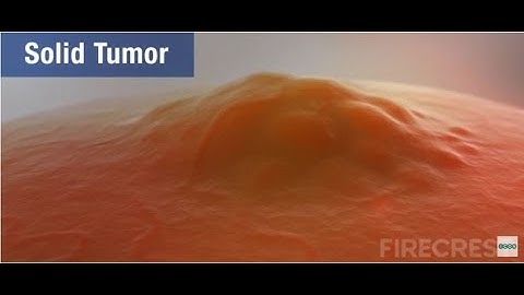 FIRECREST Medical Animations: Solid Tumors