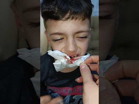 محمد ضرب تمو وهو عم يلعب مع بابا نزل الدم شو عملت غزل  