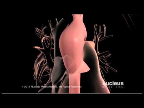 Video: Skillnaden Mellan Aorta Och Artery