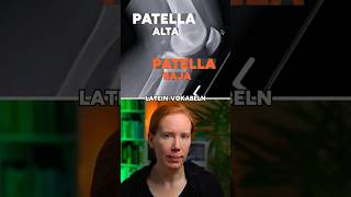 So misst du Patella alta und baja richtig #anatomie #radiologie