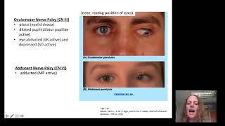 Introduction to Opthalmology