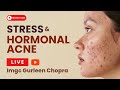 Stress  hormonal acne