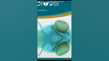 Nrf2 impacts cellular bioenergetics by controlling substrate availability for mitocho... | RTCL.TV