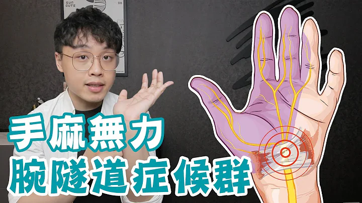 手麻無力肌萎縮，腕隧道症候群全解析！ - 天天要聞