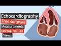 Echocardiography free software