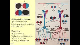 Neuroopthalmology  CRASH! Medical Review Series