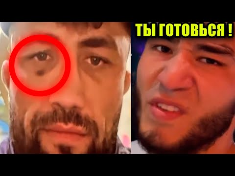 Видео: СРОЧНО! СИНЯК У ФАРИДУНА ПОД ГЛАЗОМ! КАРИМ VS ДИЕГО БРАНДАО! САМАНДАР МУРОДОВ