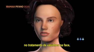 Luz Pulsada