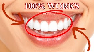 NATURAL WHITE TEETH in 3 min TEETH WHITENING HOME REMEDY how to whiten teeth दांत घर पर दांत