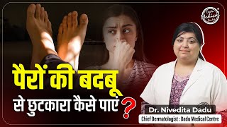 Smelly Feet Causes,Treatment &amp; Solution in Hindi | पैरों की बदबू का ईलाज | Skin Specialist in Delhi