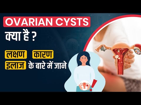 Types of ovarian