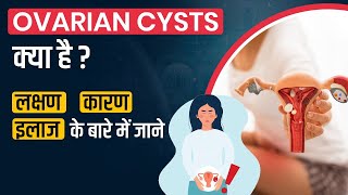 Types of ovarian cysts and how they are removed | Do all Ovarian cysts need treatment?