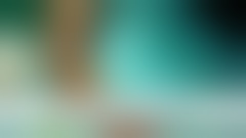 necrotising fascitis, cellulitis, debridement #youtube #dr Talha motala