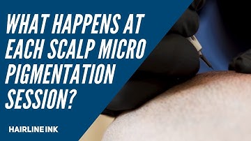 What Happens at Each Scalp Micropigmentation Session❓