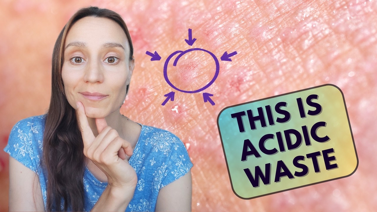 Eczema Awareness: What is the Redness and Oozing?