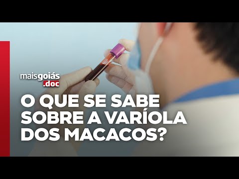 Varíola dos macacos: sintomas, tratamento e cuidados | Mais Goiás.doc