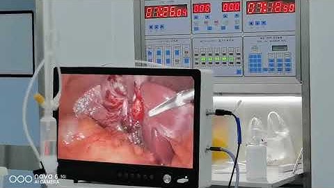 9122  Full HD Medical Portable Endoscope Camera