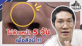 จัดการสิวเสี้ยนด้วยตัวเองโคตรง่าย