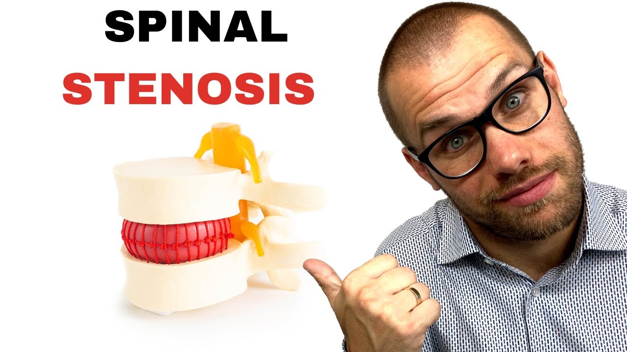 SPINAL STENOSIS - 5 Best Exercises ! - YouTube