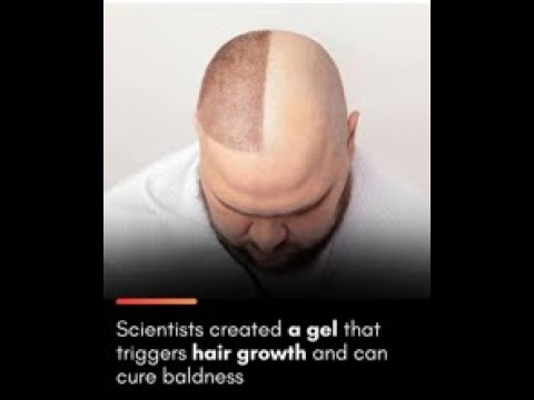 Baldness Cure in a Sugar Gel? 🍬💇‍♂️ The Shocking Breakthrough | Forget Expensive Treatments! 🤯✨