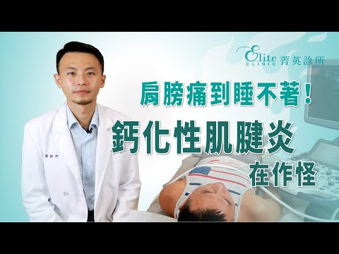 肩膀痛到睡不著！鈣化性肌腱炎如何除之而後快？