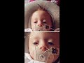 Trisomy 18 baby birth and death heartbreaking story of love and loss died in my arms 10 weeks old