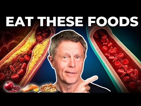Top 5 Foods to Clean Your Arteries (Backed by Science)