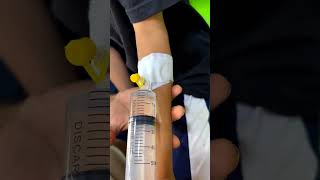 IV Line Placement #usnurse #nurse #hospital #trending #explore #medicosstuff