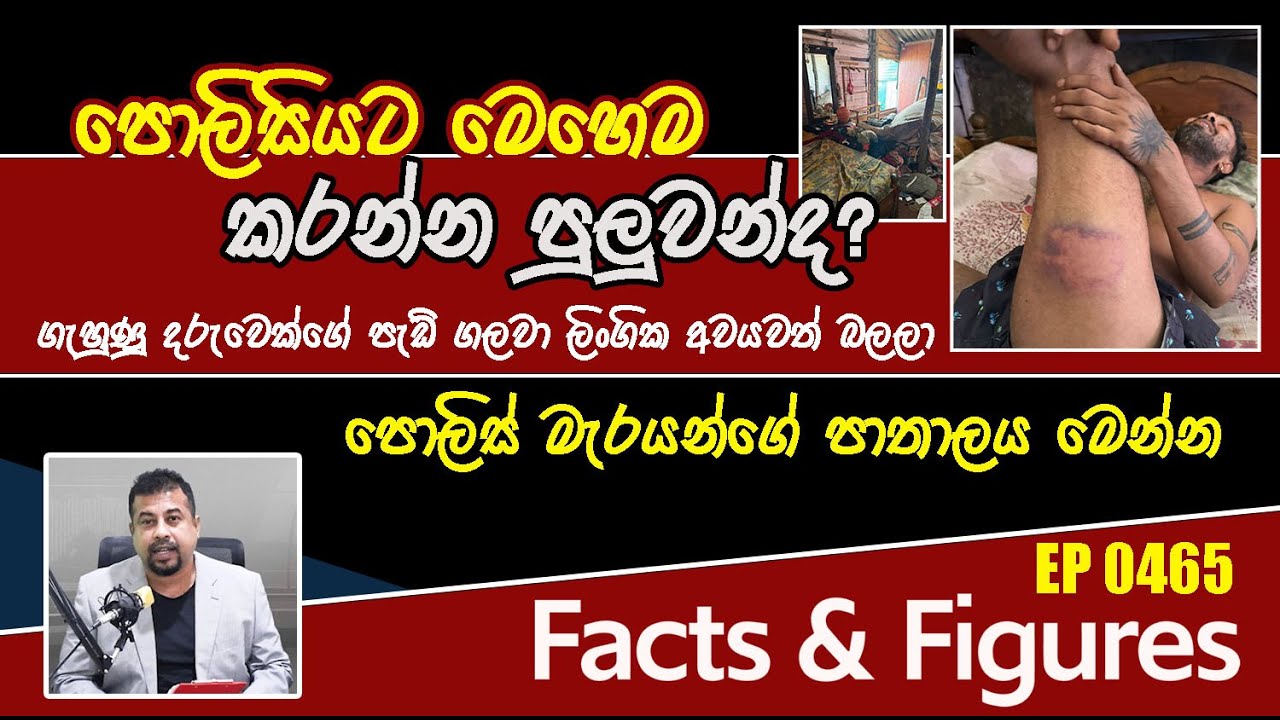 EP 0465 | මානව හිමිකම් නොකඩා කරණ පරික්ෂණයක් කරන්න - STF ගහන අමුතු ගේමක් මාට්ටු 