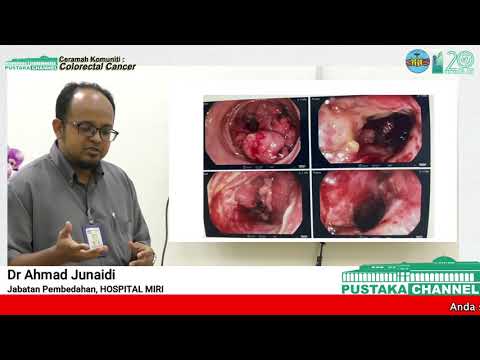 Ceramah Kesihatan: Colorectal Cancer oleh Dr. Ahmad Junaidi, Jabatan Pembedahan, Hospital Miri