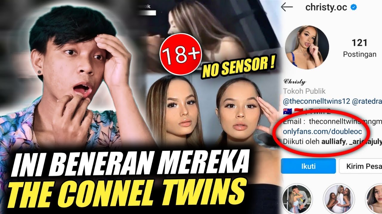 Connell twins link