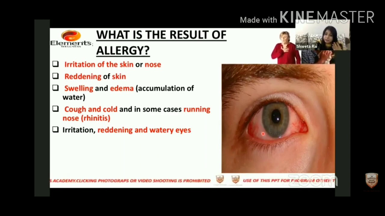 Elements wellness anti allergy TRENNING 