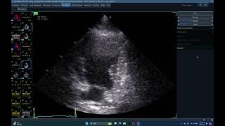 Iq 133 Auto Ef,Echopac Analysis, Echocardiography, Hepatoma,Eip, Hwd , Smallm Animal 3Sc-Rs Probe