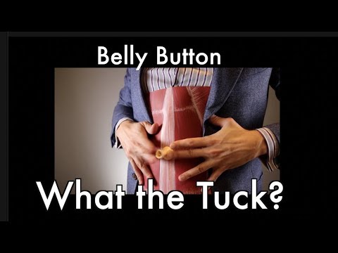 Tummy Tuck Belly Buttons???