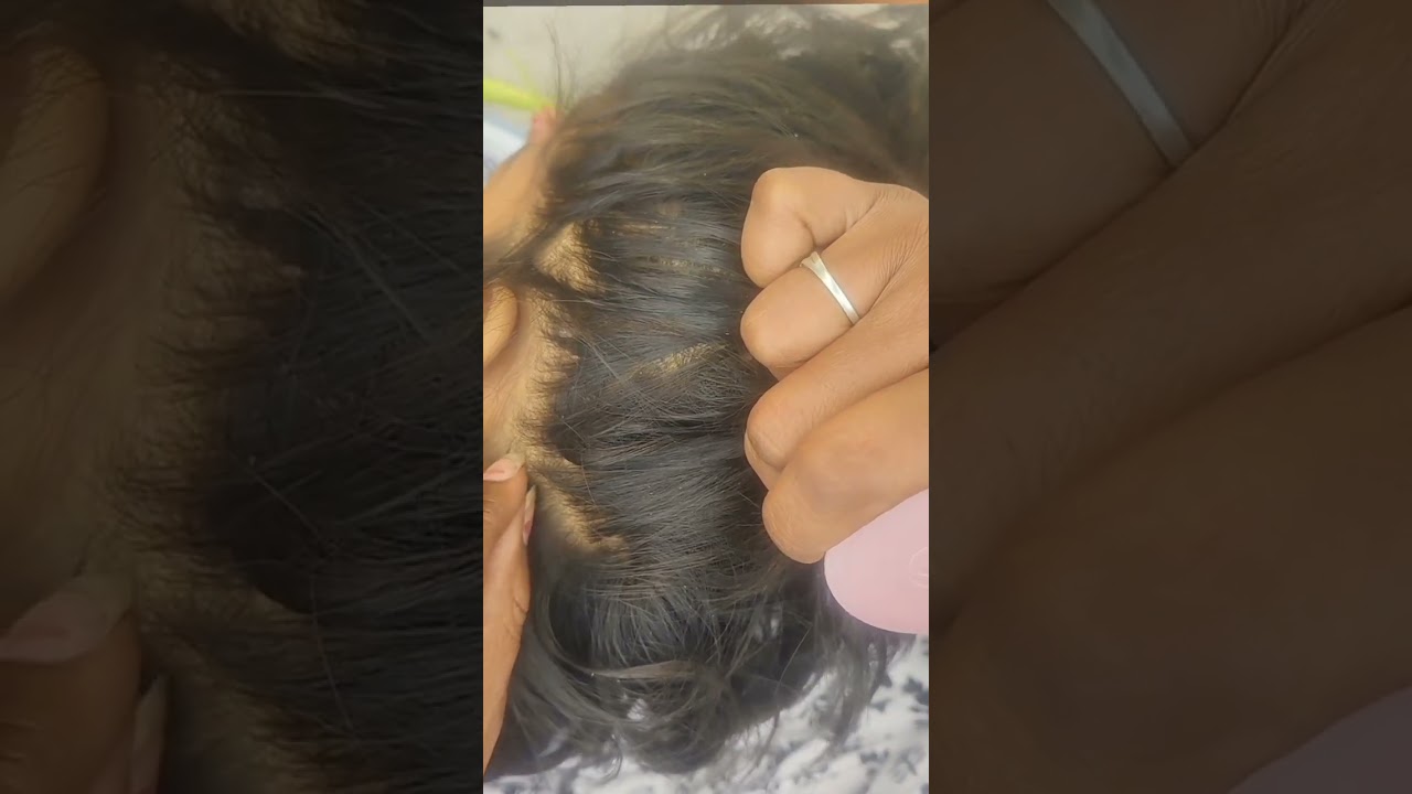 ASMR Nitpicking That Will Melt Your Stress Away