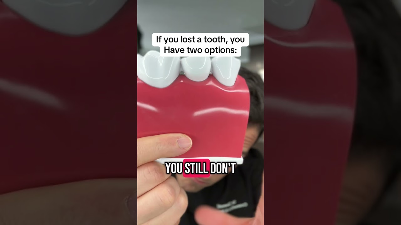 Are dental implants an option if your are missing teeth?