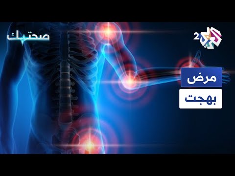 ما هو مرض بهجت
