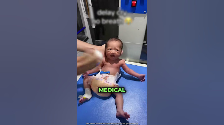 Thérapie pour bébé 😨
