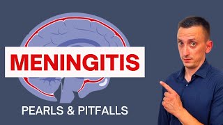 BACTERIAL MENINGITIS IN ADULTS: SYMPTOMS, CAUSES, DIAGNOSIS, AND TREATMENT