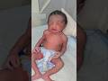 Moro Reflex in Newborn 😱#shorts #medicalshorts #babyreaction #neonatalcare #nicu #youtubeshorts