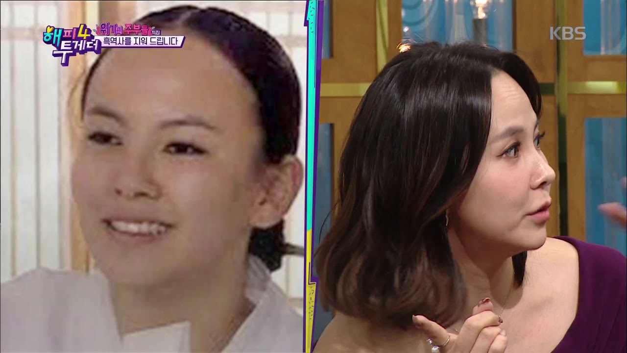 “수술했어요” 깜짝 고백 김지우, 황비홍 이마 콤플렉스 시원하게 털다☆★ [해피투게더/Happy Together Season 4] 20190425