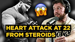 HEART ATTACK at 22 Years Old from Extreme STEROID Abuse... (even ate BURGERS on the way to hospital)