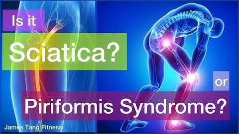 Is it sciatica or piriformis syndrome? Self-Management of back pain with James Tang Fitness