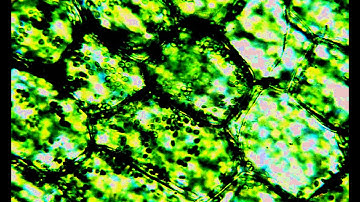 Plasmolysis in elodea cells lauren