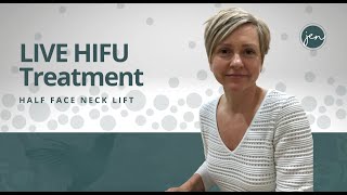 Achieve Youthful Skin: Painless LIVE HIFU Face Treatment Revealed