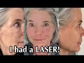 Magic trifecta to fade dark spots sun spots age spots on my 63 year old skin