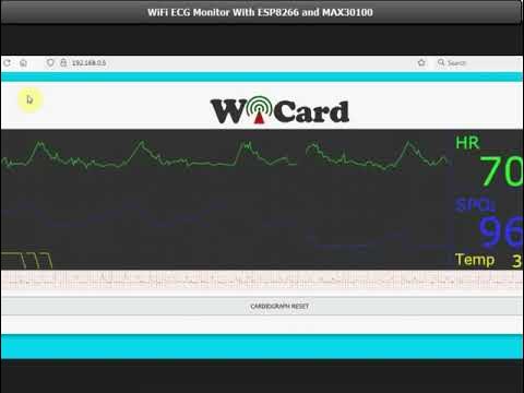 WiFi ECG Monitor With MAX30100 and ESP8266 - YouTube